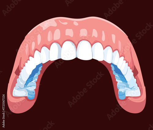 Full Upper Denture Prosthesis Displaying Artificial Teeth and Gum Material for Replacement of Missing Natural Teeth	