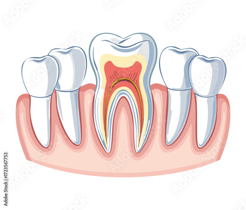 Anatomy of a tooth with gum recession, exposing the root and illustrating potential dental issues and sensitivity	