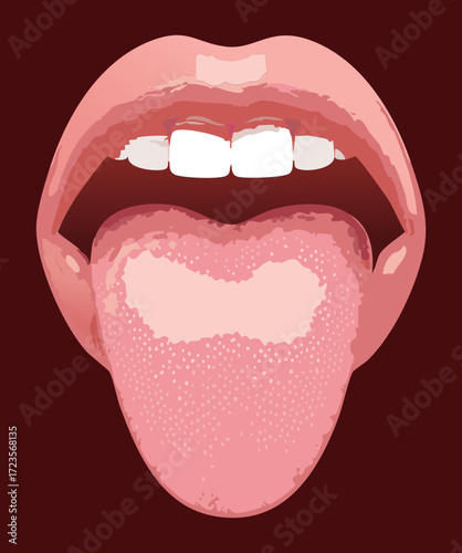 Anatomical View of the Tongue Highlighting the Location of the Palatine and Lingual Tonsils	