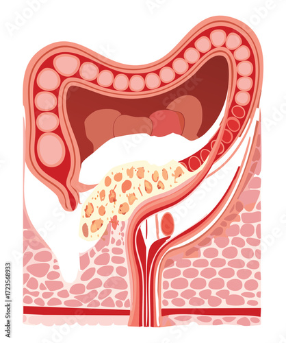 Anatomical Cross-Section of the Right Lower Abdomen Showing Appendix and Cecum Region of Colon	