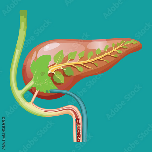 Detailed illustration of the human pancreas and duodenum, highlighting the bile duct and pancreatic fluid channels	