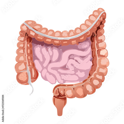 Clear view of the large intestine (colon) and small intestine anatomy, highlighting the overall structure of the lower digestive tract	