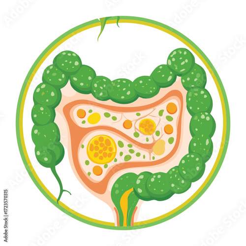 Conceptual artistic overlay showing a glowing, painful large intestine inside a silhouette of a person's abdomen, representing general digestive and gut discomfort
