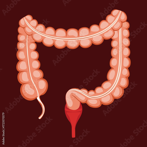 Visualization of the diagnostic colonoscopy procedure showing the endoscope instrument being maneuvered through the curves of the large intestine for examination and screening