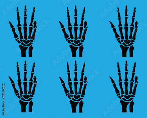 Human Skeleton Hand Illustration Vector, Black and White Anatomy on Blue Background
