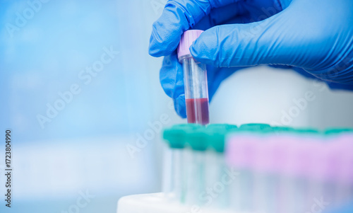 Obraz na płótnie Veterinary clinic blood test: lab work with gloved hand holding sample tube