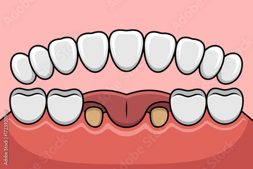 Close-up illustration of healthy and unhealthy teeth in a mouth, showing decay and enamel.