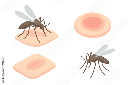 Mosquito Bite Illustration. Isometric vector illustration set mosquito proboscis bite itch: close-up mosquito feeding, skin