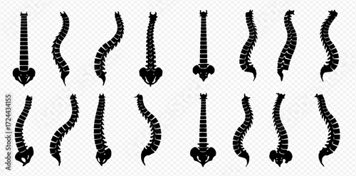 A collection of black silhouette illustrations depicting human spine anatomy, showing both healthy and curved vertebral columns.