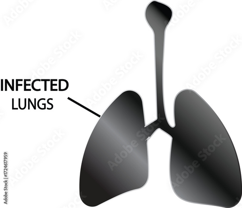 human infected lungs vector illustrator