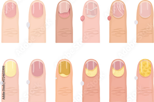 nail polish set
