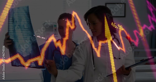 nurse holding X-ray to light doctor analyzing regions on film while waveform overlay pulsing data