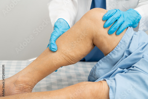 Doctor checking Asian elderly woman patient with scar knee replacement surgery in hospital.