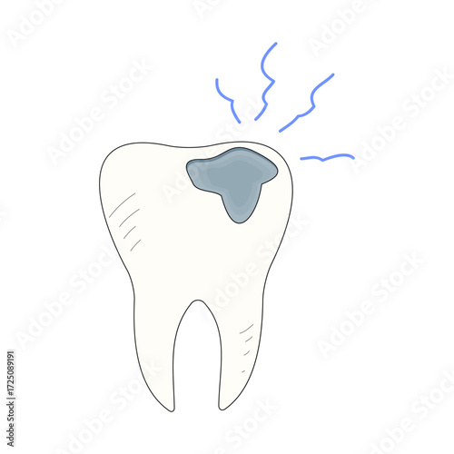 Cavities. Dirty teeth. Molar decay. Toothache. Oral health. Health theme. Dental caries. Vector illustration