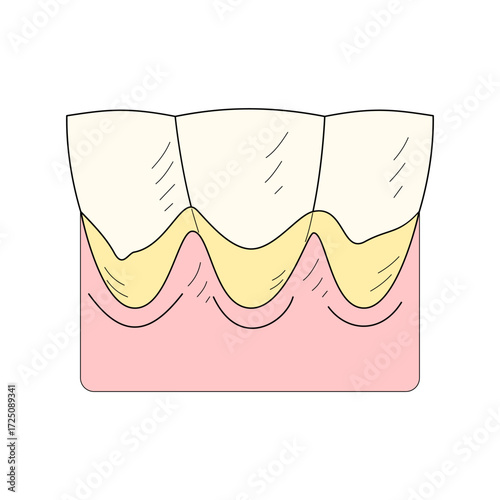 tartar. dirty teeth. oral health. health theme. Vector illustration