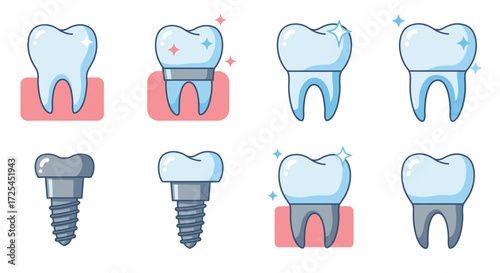Illustrative representation of various dental restorations and healthy teeth options