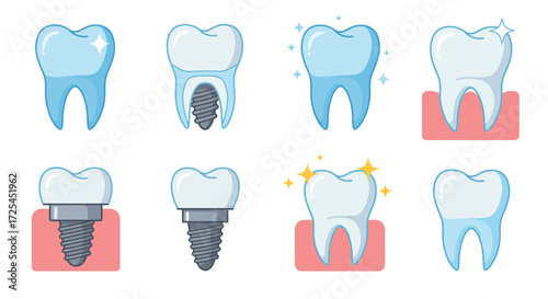 Detailed illustration of human teeth and dental implant procedures