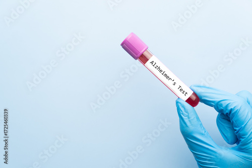 Blood sample tube with Alzheimer test label on medical laboratory technologist hands over blue background. A blood test that can help detect early signs of Alzheimer’s disease.