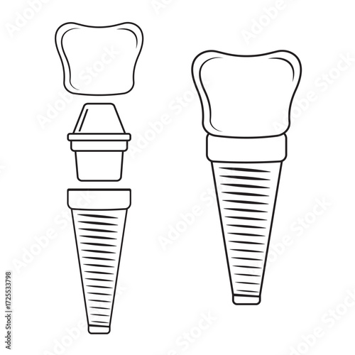 Dental implant, contour. Screw prosthesis, Illustration of dental implantation,orthodontic dental implantation