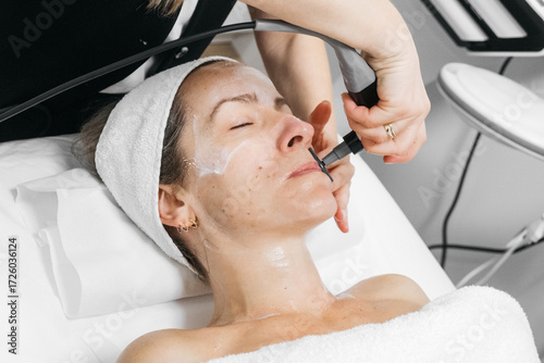 Tableau sur toile Woman receiving RF lifting treatment for facial rejuvenation, with a professiona