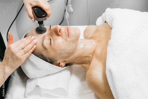 Fotografía Woman receiving RF lifting treatment for facial rejuvenation, with a professiona