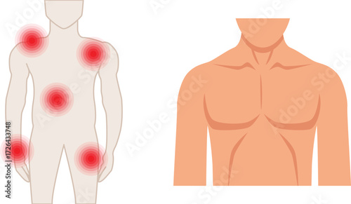 Illustration of a man with pain points in his body, the pain points are marked with red circles on the mans body