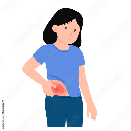 zoster virus infection disease concept