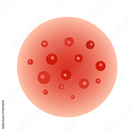 zoster virus infection disease concept