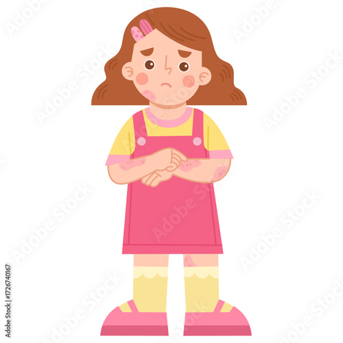 Illustration of Girl with Eczema