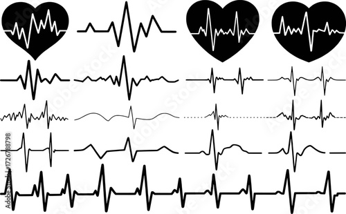 Collection of Heartbeat and EKG Line Graphics