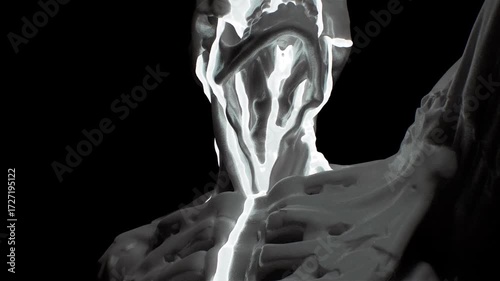  Fluid is leaking out of the skull.