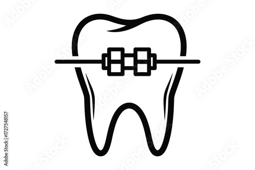 Vector art of a tooth with braces, the braces are made of metal and are attached to the tooth with brackets and wires