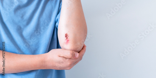 Unrecognizable child shows his elbow with noticeable abrasion and wound on elbow, experiencing pain from scratch and fresh injury requiring attention and possible medical treatment,copy space