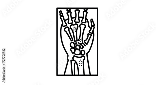 Hand X-Ray Illustration in Black and White Rectangular Frame.