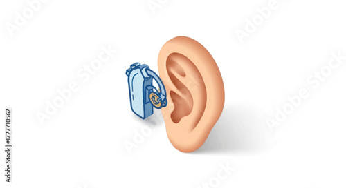 Close-up of a modern blue behind-the-ear hearing aid attached to a human ear.