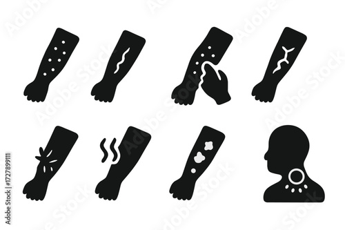 Eczema Icon Set. Solid, filled icon set of eczema flare-up signs: redness, swelling, itching, dryness, pain, heat, crusting, irritation. Solid, filled icons in