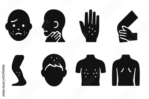 Irritation Body Part Icons. Solid, filled icon set of irritation affected body parts: face, neck, hands, arms, legs, scalp, chest, back. Line icons in only