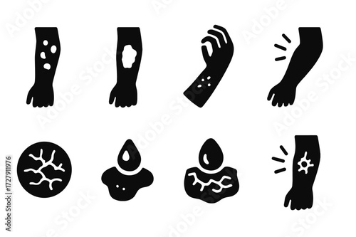 Eczema Symptoms Icons. Solid, filled icon set of eczema symptoms: red rash, dry patches, itching, swelling, cracked skin, blister, scaling, inflammation.