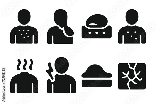 Sunburn Symptoms Icons. Solid, filled icon set of sunburn symptoms: red skin, peeling skin, blister, rash, heat waves, pain, swelling, dry skin. Solid, filled