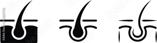 Hair Follicle Icons: Healthy, Thinning, and Lost Hair