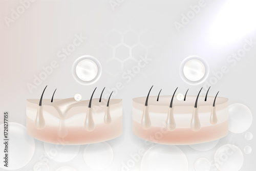 Hyaluronic acid and Niacinamide before and after hair and skin solutions ad, white collagen serum drops into skin cell with cosmetic advertising background ready to use, illustration vector.	