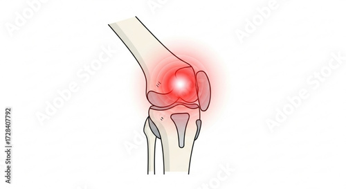 Illustration of a human knee joint with red highlighting indicating pain and inflammation in the area created with generated ai