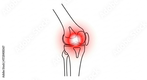Illustration of a knee joint with radiating red pain indicating inflammation or injury shown in detail created with generated ai