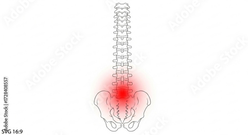 Spine and pelvis illustration showing lower back pain with red highlighting of the affected area of discomfort created with generated ai