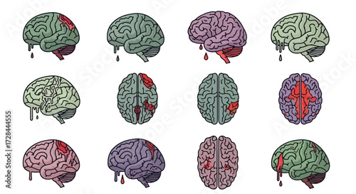 A collection of stylized human brains in various colors and angles, showing different types of injuries and bleeding, depicted as vector illustrations.