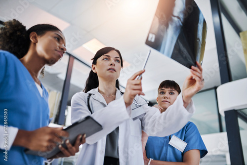 Bild auf Leinwand Women, doctor and nurse for xray, review and healthcare for knee treatment in hospital