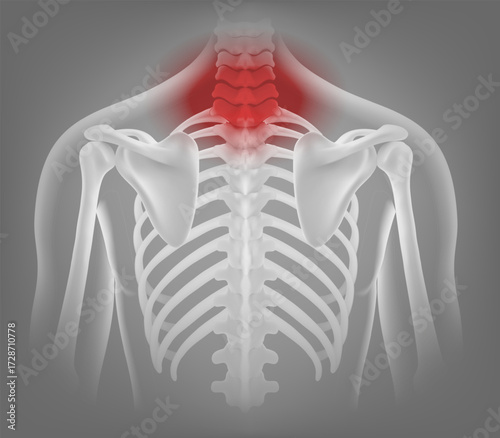  3D medical illustration of the human upper torso skeleton from the back, highlighting the cervical and upper thoracic spine with a glowing red pain indicator