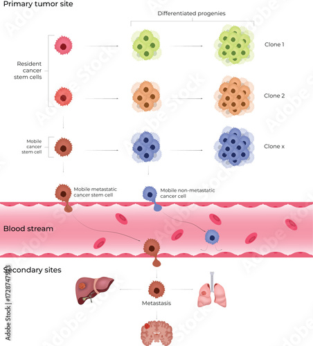 Cancer Metastasis: A Visual Overview of Tumour Progression