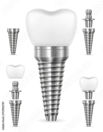 tooth metal human implant cartoon stock vector illustration isolated on white background