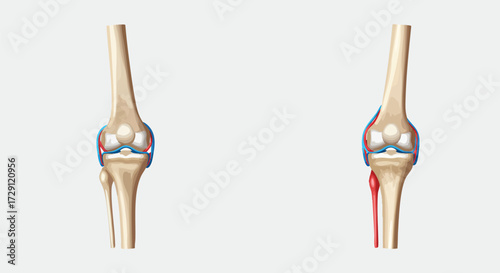Medical Illustration of Human Knee Joint Anatomy Anterior and Lateral Views